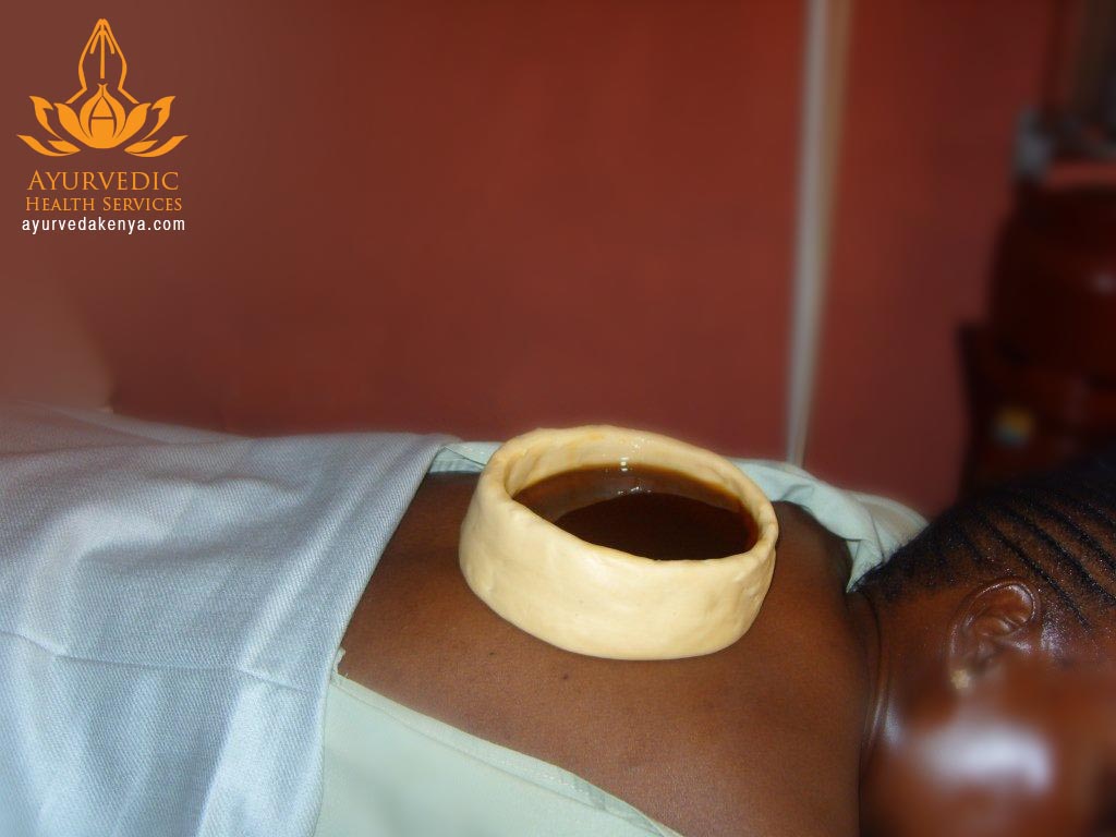 Warm medicated oil held in a dough ring over a patient’s lower back