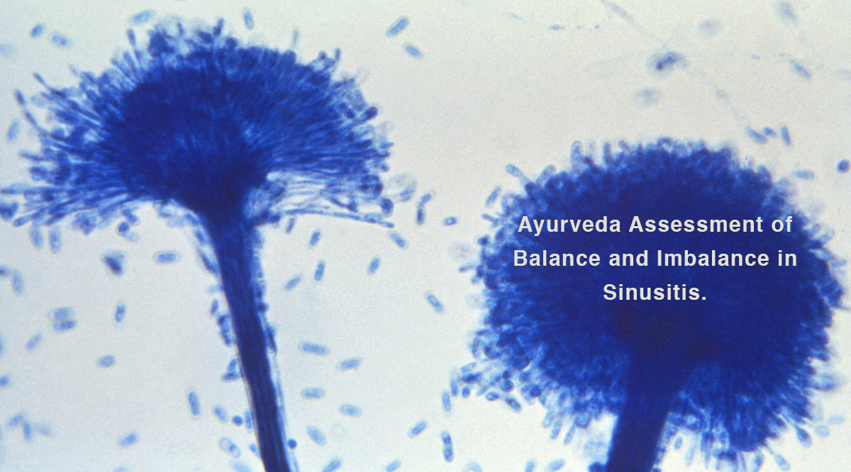 Ayurveda treatment for sinusitis